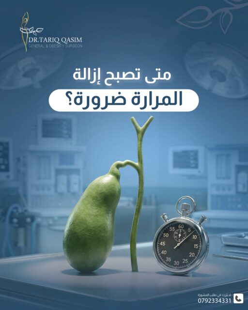 متى تصبح إزالة المرارة ضرورة؟للاستشارة الطبية الدقيقة:📞 0792334331#الدكتور_طارق_قاسم #الجراحة_العامّة_والمنظار #المرارة