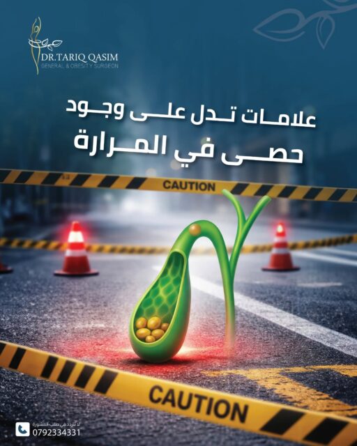 علامات تدل على وجود حصى في المرارة
للاستشارة الطبية الدقيقة:
📞 0792334331
#الدكتور_طارق_قاسم #الجراحة_العامّة_والمنظار #المرارة